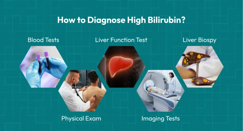 How to Diagnose High Bilirubin?